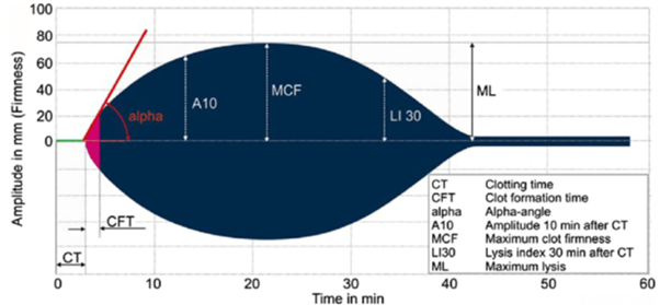 Figure 3. Depiction of a ROTEM® Delta tracing.