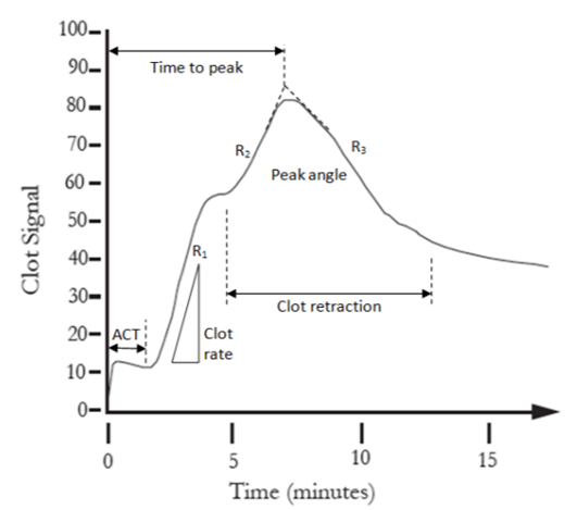 Figure 6. Depiction of a SonoClot® tracing. 