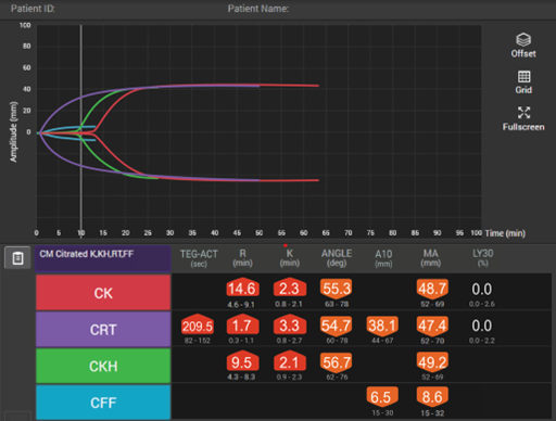 TEG® 6s tracing in a patient undergoing extracorporeal membrane oxygenation (ECMO)