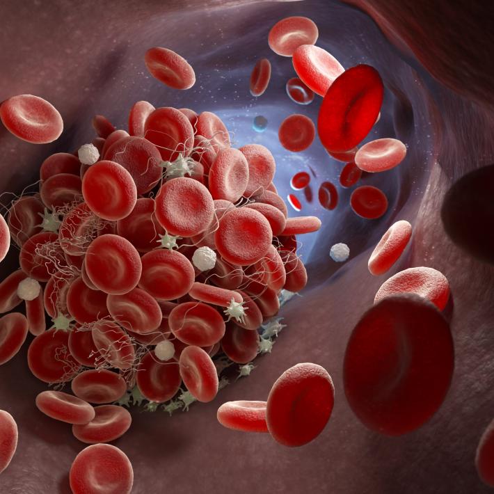 clotting blood cells
